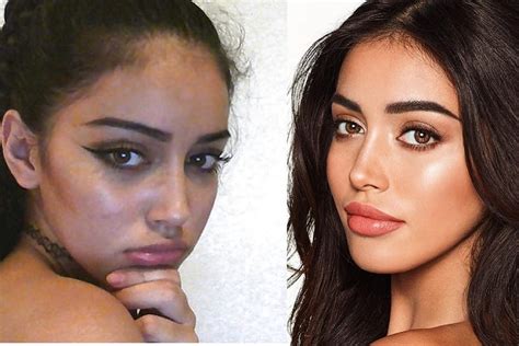 Cindy Kimberly Before and After Plastic Surgery: Lips, Nose, Face